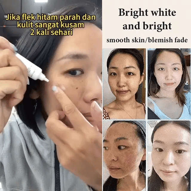 Whitening and Spot-Removing Cream💦-1