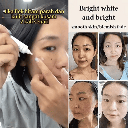 Whitening and Spot-Removing Cream💦-1