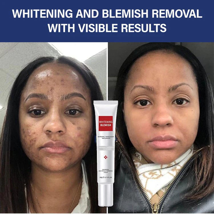 Whitening and Spot-Removing Cream💦-2