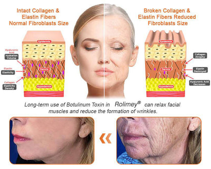 🧑‍⚕️𝑶𝒇𝒇𝒊𝒄𝒊𝒂𝒍 𝑺𝒕𝒐𝒓𝒆 | 𝐑𝐨𝐥𝐢𝐦𝐞𝐲® 𝐁𝐨𝐭𝐨𝐱 𝐁𝐞𝐞 𝐕𝐞𝐧𝐨𝐦 𝐅𝐢𝐫𝐦𝐢𝐧𝐠 𝐒𝐞𝐫𝐮𝐦 𝐒𝐭𝐢𝐜𝐤 - 𝐓𝐚𝐫𝐠𝐞𝐭𝐬 𝐒𝐚𝐠𝐠𝐢𝐧𝐠 𝐒𝐤𝐢𝐧 & 𝐖𝐫𝐢𝐧𝐤𝐥𝐞𝐬 𝐀𝐥𝐥 𝐎𝐯𝐞𝐫 𝐁𝐨𝐝𝐲 𝐰𝐢𝐭𝐡 𝐀𝐝𝐯𝐚𝐧𝐜𝐞𝐝 𝐏𝐞𝐩𝐭𝐢𝐝𝐞 𝐓𝐞𝐜𝐡𝐧𝐨𝐥𝐨𝐠𝐲, 𝐕𝐢𝐬𝐢𝐛𝐥𝐞 𝐑𝐞𝐬𝐮𝐥𝐭𝐬 𝐢𝐧 𝟑 𝐃𝐚𝐲𝐬-7