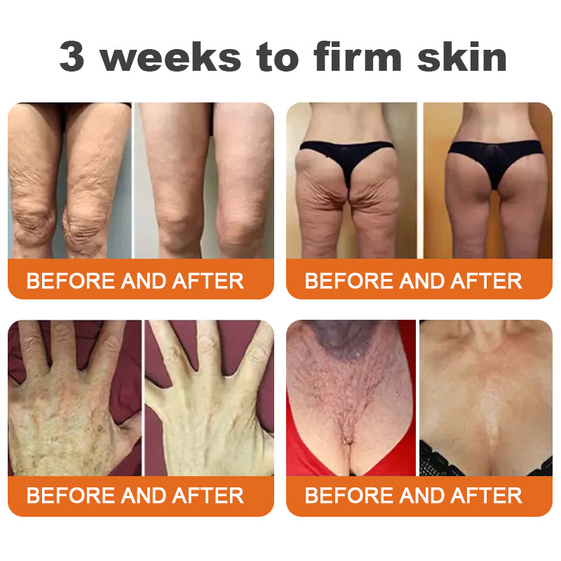 🧑‍⚕️𝑶𝒇𝒇𝒊𝒄𝒊𝒂𝒍 𝑺𝒕𝒐𝒓𝒆 | 𝐑𝐨𝐥𝐢𝐦𝐞𝐲® 𝐁𝐨𝐭𝐨𝐱 𝐁𝐞𝐞 𝐕𝐞𝐧𝐨𝐦 𝐅𝐢𝐫𝐦𝐢𝐧𝐠 𝐒𝐞𝐫𝐮𝐦 𝐒𝐭𝐢𝐜𝐤 - 𝐓𝐚𝐫𝐠𝐞𝐭𝐬 𝐒𝐚𝐠𝐠𝐢𝐧𝐠 𝐒𝐤𝐢𝐧 & 𝐖𝐫𝐢𝐧𝐤𝐥𝐞𝐬 𝐀𝐥𝐥 𝐎𝐯𝐞𝐫 𝐁𝐨𝐝𝐲 𝐰𝐢𝐭𝐡 𝐀𝐝𝐯𝐚𝐧𝐜𝐞𝐝 𝐏𝐞𝐩𝐭𝐢𝐝𝐞 𝐓𝐞𝐜𝐡𝐧𝐨𝐥𝐨𝐠𝐲, 𝐕𝐢𝐬𝐢𝐛𝐥𝐞 𝐑𝐞𝐬𝐮𝐥𝐭𝐬 𝐢𝐧 𝟑 𝐃𝐚𝐲𝐬-3
