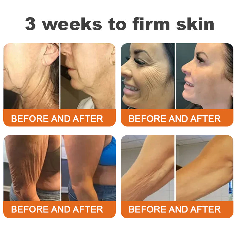 🧑‍⚕️𝑶𝒇𝒇𝒊𝒄𝒊𝒂𝒍 𝑺𝒕𝒐𝒓𝒆 | 𝐑𝐨𝐥𝐢𝐦𝐞𝐲® 𝐁𝐨𝐭𝐨𝐱 𝐁𝐞𝐞 𝐕𝐞𝐧𝐨𝐦 𝐅𝐢𝐫𝐦𝐢𝐧𝐠 𝐒𝐞𝐫𝐮𝐦 𝐒𝐭𝐢𝐜𝐤 - 𝐓𝐚𝐫𝐠𝐞𝐭𝐬 𝐒𝐚𝐠𝐠𝐢𝐧𝐠 𝐒𝐤𝐢𝐧 & 𝐖𝐫𝐢𝐧𝐤𝐥𝐞𝐬 𝐀𝐥𝐥 𝐎𝐯𝐞𝐫 𝐁𝐨𝐝𝐲 𝐰𝐢𝐭𝐡 𝐀𝐝𝐯𝐚𝐧𝐜𝐞𝐝 𝐏𝐞𝐩𝐭𝐢𝐝𝐞 𝐓𝐞𝐜𝐡𝐧𝐨𝐥𝐨𝐠𝐲, 𝐕𝐢𝐬𝐢𝐛𝐥𝐞 𝐑𝐞𝐬𝐮𝐥𝐭𝐬 𝐢𝐧 𝟑 𝐃𝐚𝐲𝐬-2