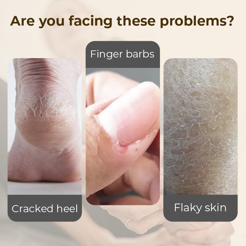Hydrating and Anti-Cracking Foot Cream-1