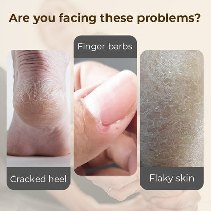 Hydrating and Anti-Cracking Foot Cream-1