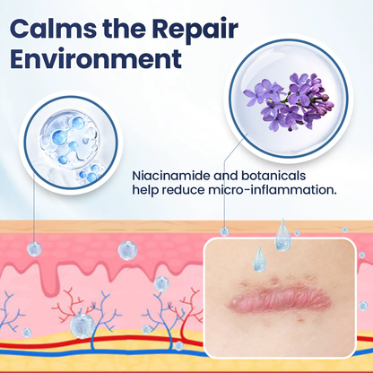 𝑶𝒇𝒇𝒊𝒄𝒊𝒂𝒍 𝑺𝒕𝒐𝒓𝒆 | LBMLBM® Texture Repair Gel — Say Goodbye to Stubborn Scars & Uneven Texture in 4 Weeks-8