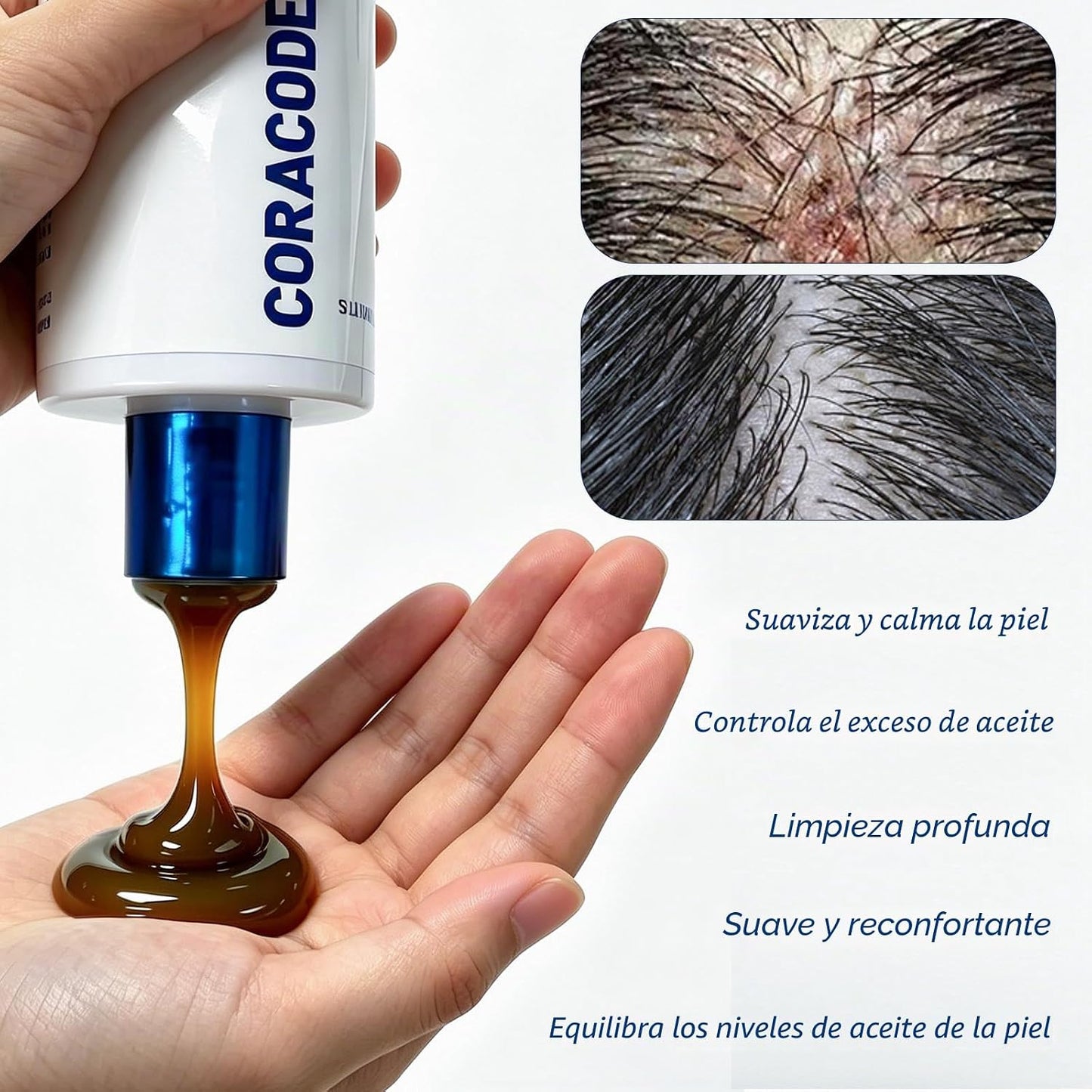 Folliculitis shampoo for itchy, flaky scalps; purifying formula to soothe and balance the scalp; care for oily scalps; for men and women.