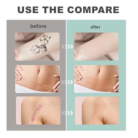 Tattoo cover-up tape, 2" x 16.4' roll; waterproof and sweat-resistant, invisible and breathable; cuttable skin-tone tattoo cover patches and concealers.