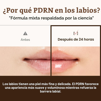 Dr. Reju-All Advanced PDRN - Rejuvenating Lip Serum - Moisturizing Lip Balm with Lipozip PDRN for Glossy, Dewy Lips - Gentle Exfoliating & Smoothing Lip Moisturizer - Hibiscus & Lactic Acid - 0.3 fl oz