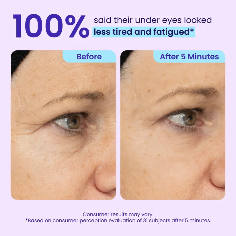 Final 3 Hours: 40%OFF🔥 Instant Lift Eye Gel for Puffiness, Bags & Dark Circles-2