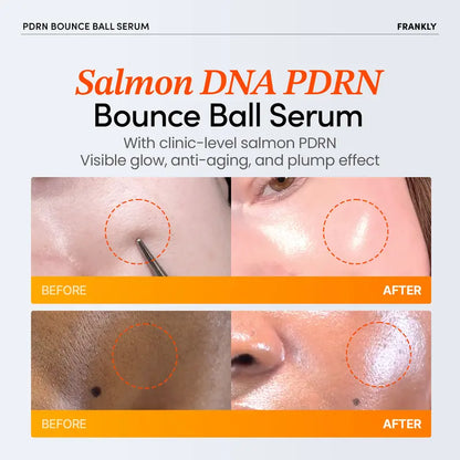 [FRANKLY] PDRN Bounce Ball Serum | 99% Pure Salmon DNA Moisturizer for Skin Repair & Glow Skin | Barrier Repair, Glow Skin, Plumping Effect, Korean Skincare, Lightweight