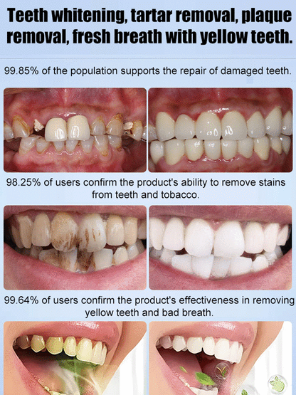 🖤2026 New Year · 40% OFF🖤Medical Grade Recombinant Oral Repair Mousse-4