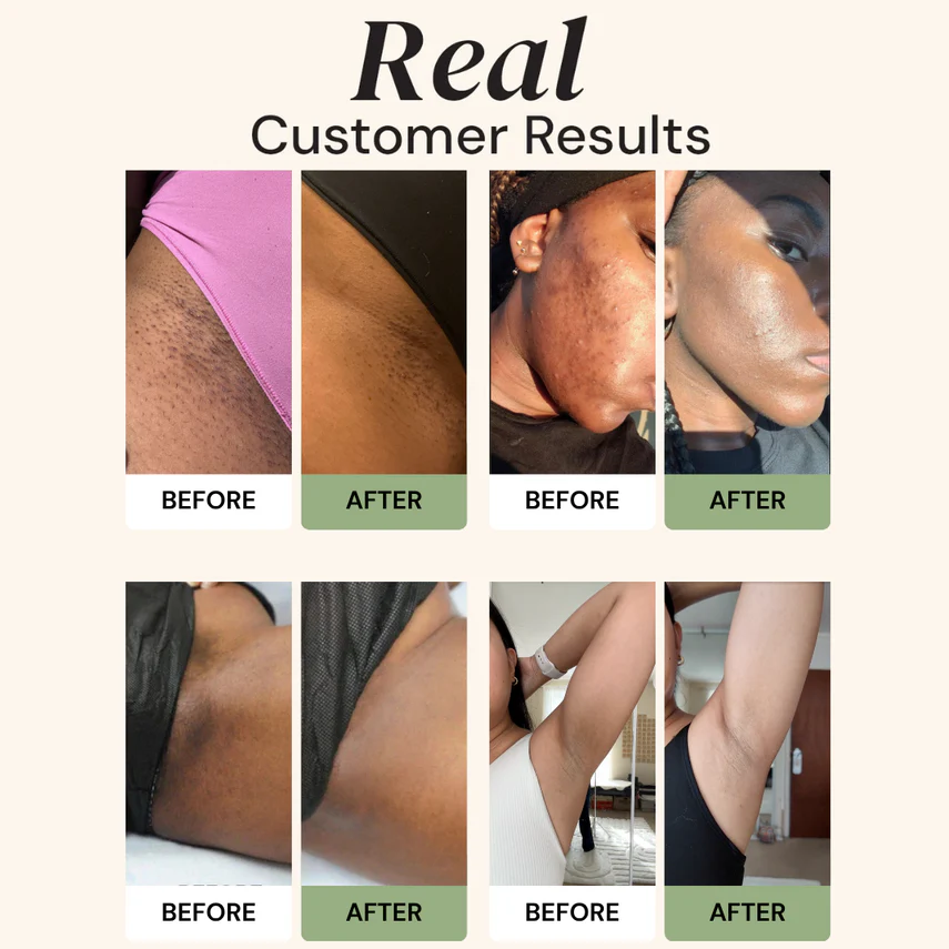 CuraGlow Anti-Spots & Hyperpigmentation Soap-2