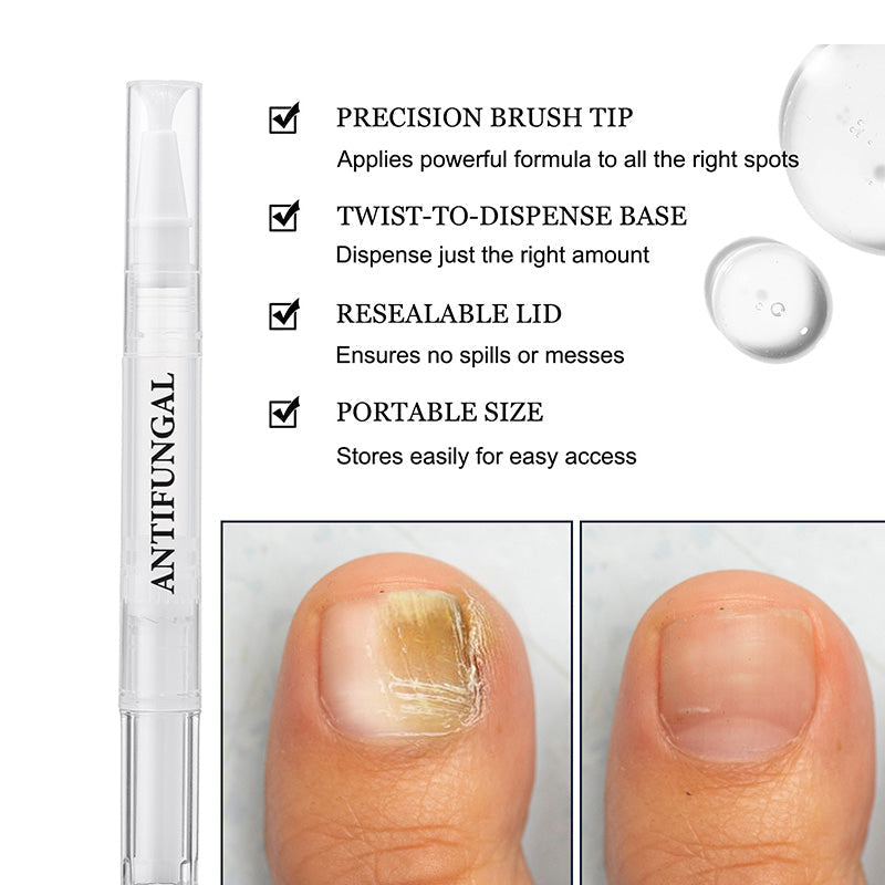 🖤2026 New Year · 40% OFF🖤Toenail Fungus Treatment Pen for Damaged Nails-4