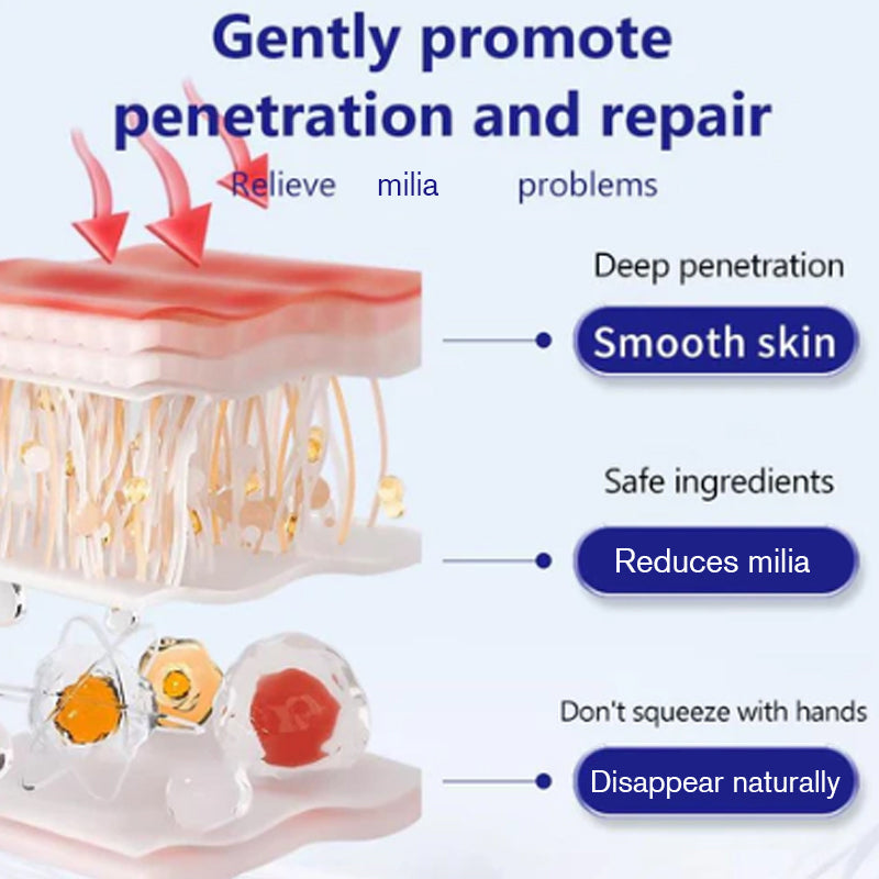 Advanced Milia Remover Serum-3