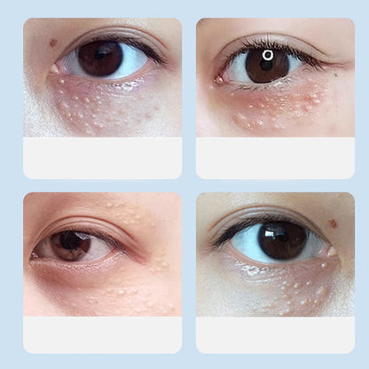 Advanced Milia Remover Serum-4