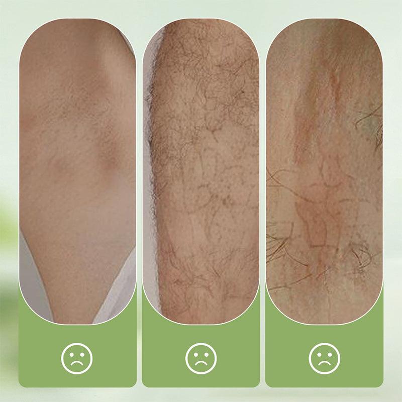 Gentle and Non-Irritating Hair Removal Cream 🎁Free: Hair removal scraper-4
