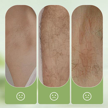 Gentle and Non-Irritating Hair Removal Cream 🎁Free: Hair removal scraper-4
