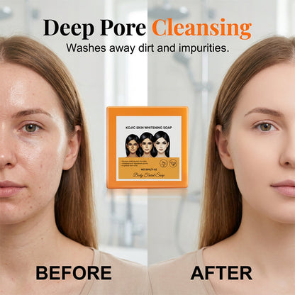 Moisturizing Facial Cleansing Soap-1