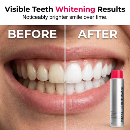 🏆2026 SALE -Advanced Stain-Lifting Whitening Mouthwash: Visible Debris Removal & Fresh Breath