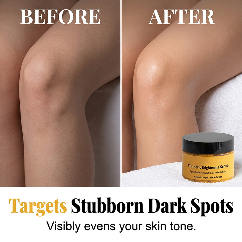 ✨Last Day Buy 2 Get 1 Free💗Turmeric Exfoliating Body Scrub
