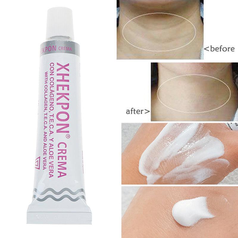 XHEKPON Face And Neck Cream-2